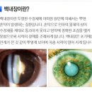 스위스 효소