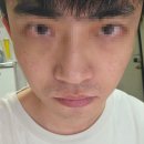 알파안경 | 눈밑지 뷰티 디바이스 추천 알파킷 아이코어샷 후기!!!