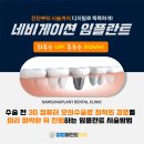 삼성플란트치과 이미지