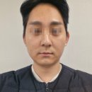 닥터쁘띠의원마곡점 | 결혼 전 남친 끌고가서 티타늄리프팅 받고옴 [비아프의원]