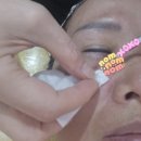 석천로16번길 | 부천 &#34;중동역 피부맛집&#34; [스무살에머물다 상동점]비립종 좁쌀 여드름 관리