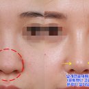 이미지성형외과 이미지