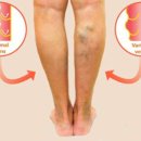 효성한의원 이미지