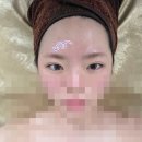 본 스킨 앤 바디 | [문정 에스테틱] 플라즈마 관리 '본스킨앤바디' 추천 후기