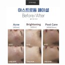 산소피부과의원 네이버블로그
