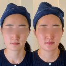 (유)제이티솔루션 | [전남/나주]나주피부샵 미모오른 알테온 리프팅관리 슈퍼젝션 나주신부관리