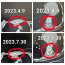 유방암4기 간폐뼈림프피부골반 전이 이롬플러스 황성주생식 후기