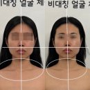 동안비결뷰티 | [평택] 동안비결뷰티 비대칭 체형윤곽관리 후기