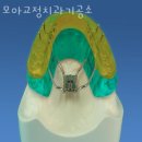 모아치과기공소 이미지