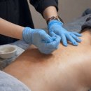 셀앤수 | 구리 남양주 다산동 오래된 등드름, 색소, 흉터 전문점 셀앤수 추천!