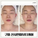 선샤인뷰티 | 구미얼굴관리 찾다가 발견한 곳, 선샤인미뷰티케어 윤곽관리 비대칭 관리 후기