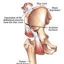 더바른핏 이미지