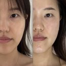 양덕동204 | 마산피부관리, 온다리프팅 후기 : [마산, 양덕동] '로에르에스테틱'