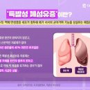 폐섬유증 원인 증상 치료 폐섬유화 검사 특발성 폐섬유증 이미지