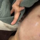 퍼나머널뷰티 | 대구 달서구 여드름 압출 문제성 피부 진정 재생관리 후기｜문제성 피부라면 퍼나머널뷰티