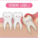 이편한용치과의원 | 범계 턱편한 사랑니 치과의원에서 인생 첫 반매복 사랑니 발치 후기 및 실비 청구