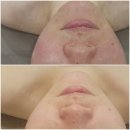 주르드스파 | 약방엔 감초 라온에스테틱에는 뷰티메드 드라이&브로티시 라인이 없어서는 안됩니다