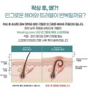 유.케이 | 인그로운 헤어 고민 끝 케이케어유 스프레이 직접 써본 후기