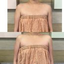 포이에마 | 영통 팔뚝관리 포이에마피부샵 후기