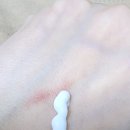 [생활 연고 추천]D-판테놀 연고 사용 후기(전후 사진 비교)