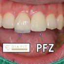 FIT치과기공소 이미지