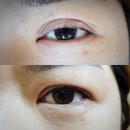 뷰티라썸