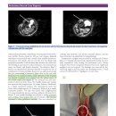 Carpal synovial cyst 환자의 MRI 상 finding 및 surgical treatment에 대한 case report 이미지