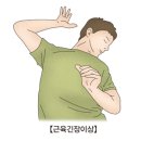 근육 긴장 이상증(Dystonia) 뇌신경 정신질환이란? 이미지