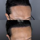 모리샵 | 두피문신 고민이라면? 모리샵 일산본점 방문 후기