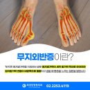 최경진정형외과의원 네이버블로그