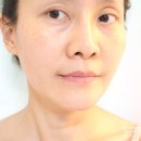 (주)대성홈메디케어 | 메디테라피 인모톡스 펩타이드 샷 크림 바르고 석션젯으로 윤곽 케어해요
