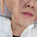 청주에스테틱 추천 | 가경동 올스킨 여드름케어관리 케어샵 후기