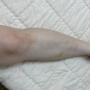 마곡 산후관리 바디 림프순환으로 부종빼기 더나다움 후기