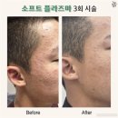 자연을더스킨케어 네이버블로그