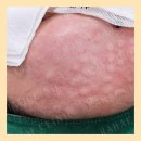 강남라해의원 이미지