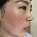 미인록 네이버블로그