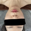 울산 윤곽관리 잘하는 미뇽드뷰티 관리후기