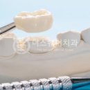 더스퀘어치과기공소 이미지