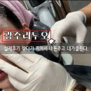 서울지구병원 | 광주 리투오 100% 내돈내산 후기 상무지구피부과 리쥬란 병행 시술과정 통증효과