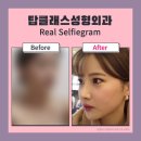 탑클래스성형외과의원 이미지