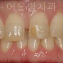 어울림 치과의원 이미지