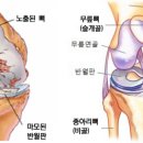 나아짐 이미지