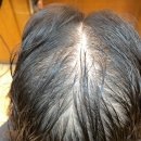 여성 탈모 고민 끝! 갈라지는 모류 교정 &amp; 극손상모발 복구 클리닉으로 여신 머릿결 완성 이미지