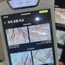 리오시스칼프