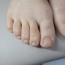 추새로병원 | 관고동 내성발톱 무좀병원에서 해결해 본 후기