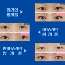 미호성형외과의원 이미지