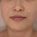 누리스킨케어 | 청주 피부관리 가경동 오아유에스테틱 리프팅관리 후기