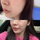 네이처스 비타민샵 인천점 | 검단피부관리 비비드엘 인천점 | 효과 좋은 미백관리 후기