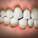 고운이치과의원 이미지