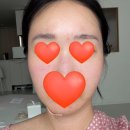톤앤업피부과의원 | [신사역피부과] 세레아의원 티타늄 리프팅으로 무너진 턱선 심폐소생하고 온 솔직후기